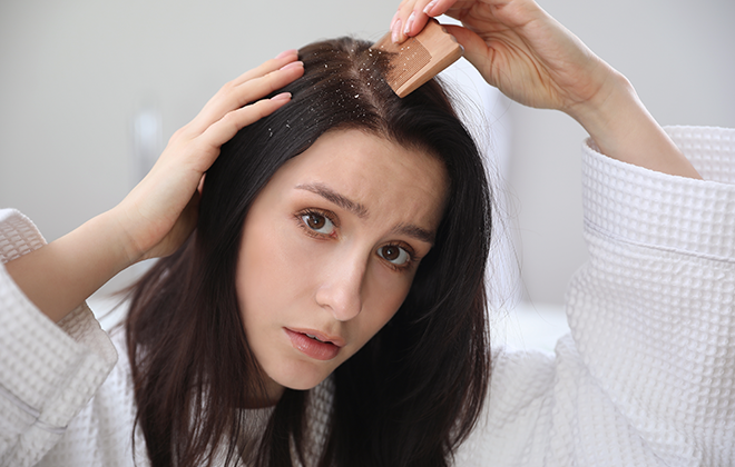 Эффективные средства для лечения перхоти