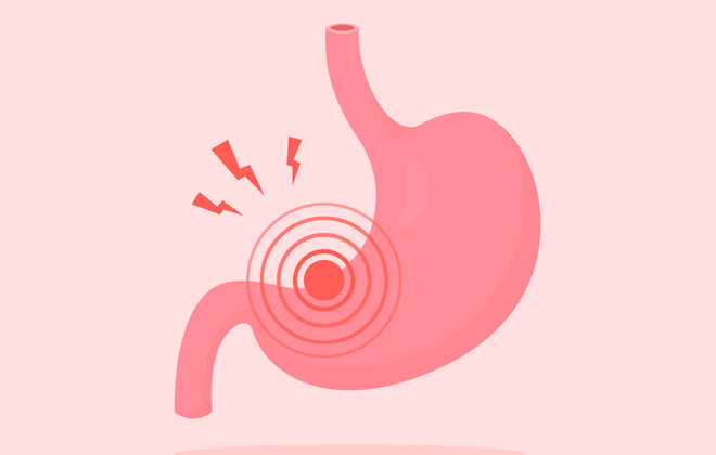 Гастрит: причины, симптомы, лечение