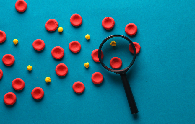 Гиперхолестеринемия: причины, симптомы и методы снижения холестерина