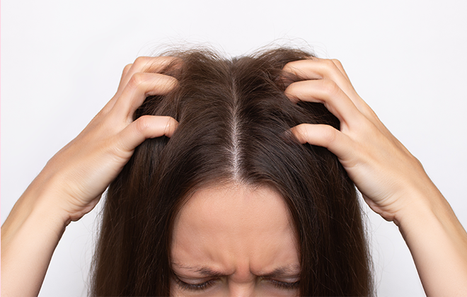 Как бороться с перхотью: советы и рекомендации специалистов