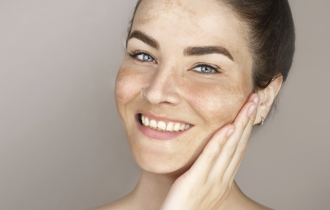 Пигментные пятна: причины появления и эффективные методы коррекции