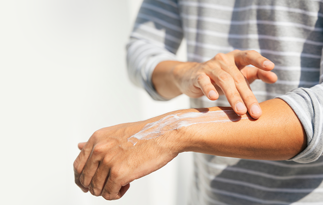 Термический ожог: как распознать степень и правильно оказать помощь