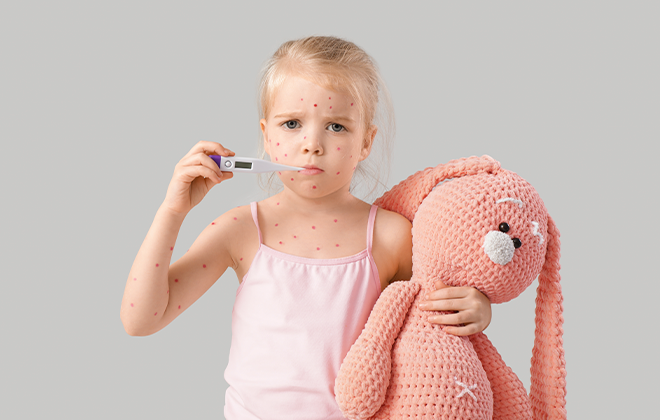 Ветряная оспа: симптомы, лечение