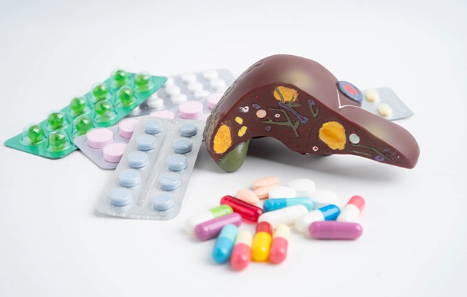 Жировой гепатоз: как предотвратить и лечить жировую болезнь печени